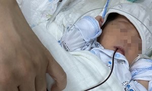 Vừa sinh ra, trẻ đã nôn ra máu, bác sĩ cảnh báo cha mẹ (18/12/2022)